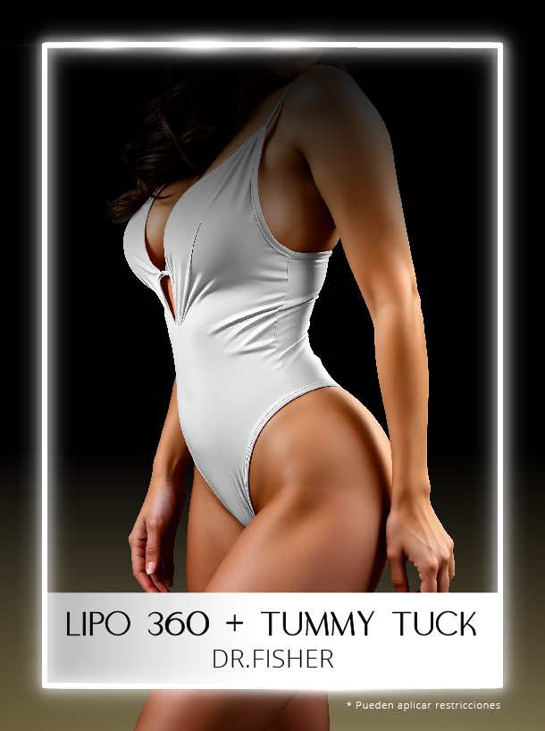 Tummy Tuck más Lipo 360 con el Dr Fisher