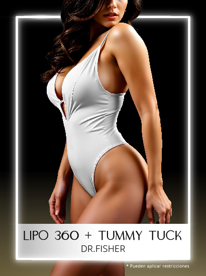 Tummy Tuck más Lipo 360 con el Dr Fisher