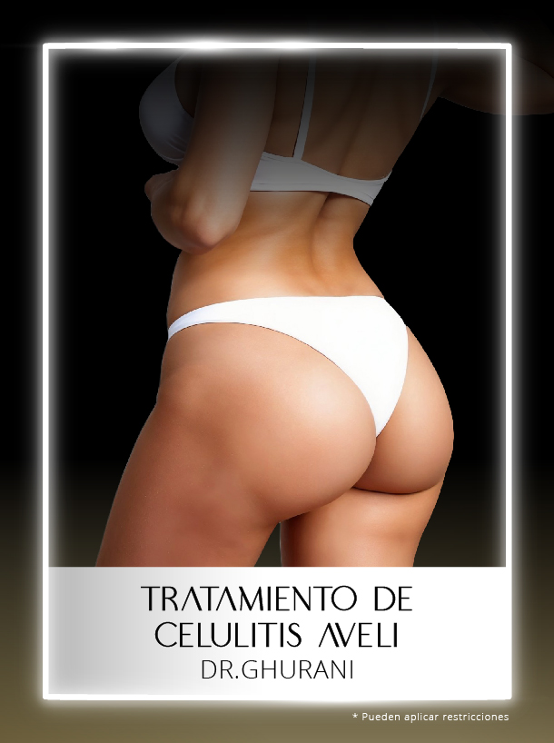 Aveli para la celulitis  con el Dr Ghurani