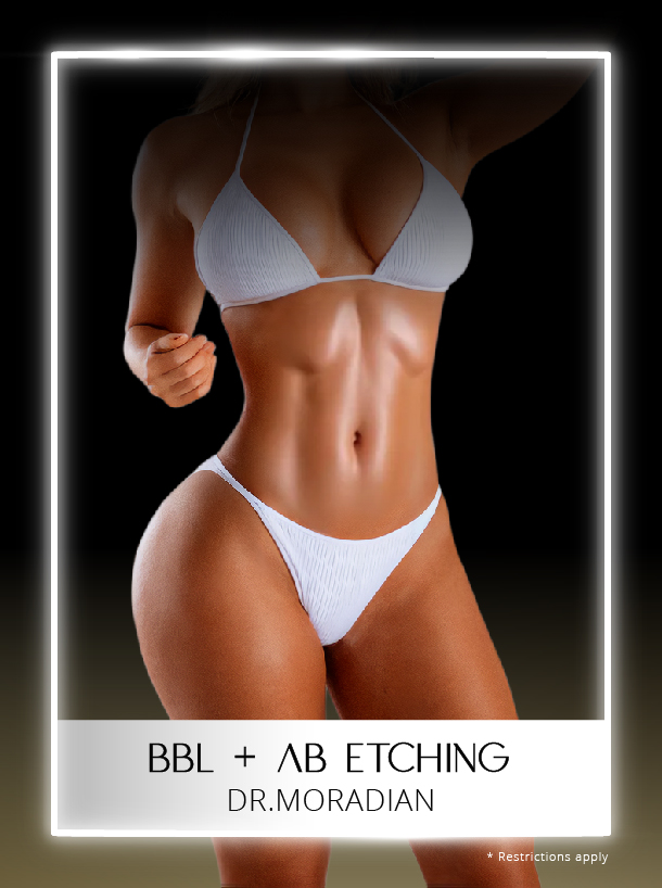 BBL plus Ab etching with Dr Moradian
