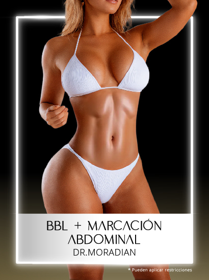 BBL más Marcación Abdominal con el Dr Moradian