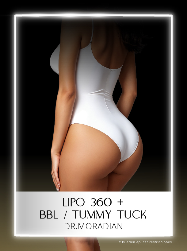 Lipo 360 BBL y Tummy Tuck con Dr Moradian