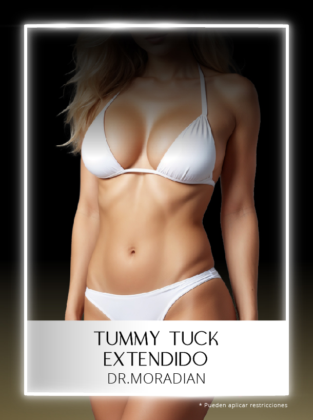 Tummy Tuck Extendido con el Dr Moradian