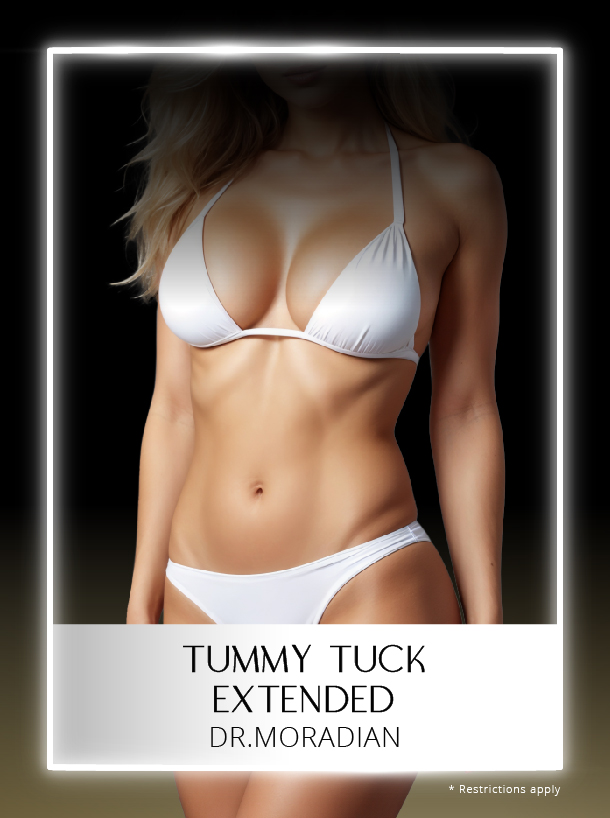 Tummy Tuck Extended with Dr Moradian