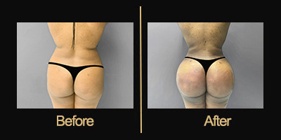 Dr Gallery Before & After