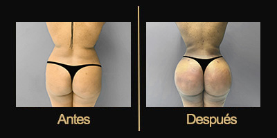 Dr Galería Antes & Después