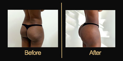 Dr Gallery Before & After
