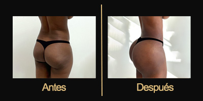 Dr Galería Antes & Después