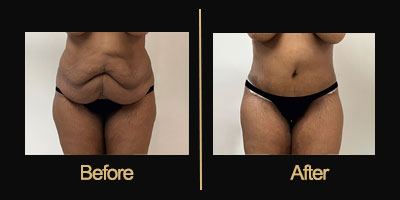 Dr Gallery Before & After