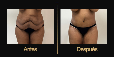 Dr Galería Antes & Después