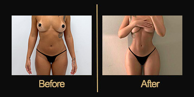 Dr Gallery Before & After