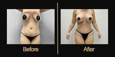 Dr Gallery Before & After