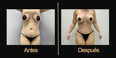 Dr Galería Antes & Después