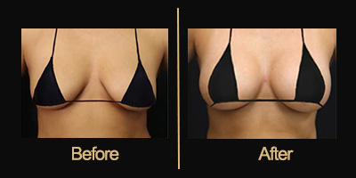 Dr Gallery Before & After