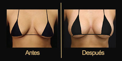 Dr Galería Antes & Después