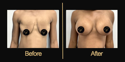 Dr Gallery Before & After