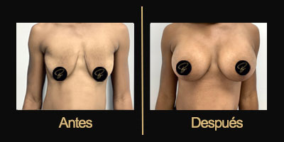 Dr Galería Antes & Después