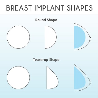 different breast implant shapes