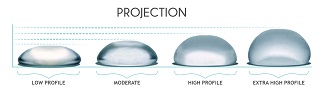 projection profile breast implants