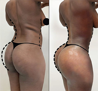 body instagram post reduce waist