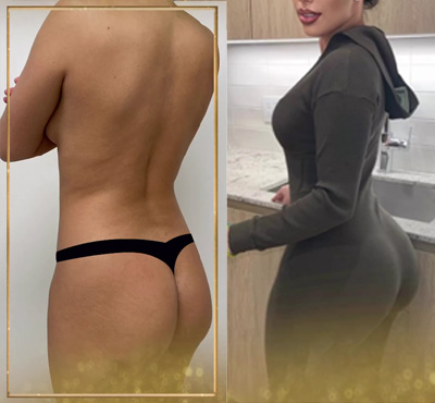 icon instagram post skinny bbl